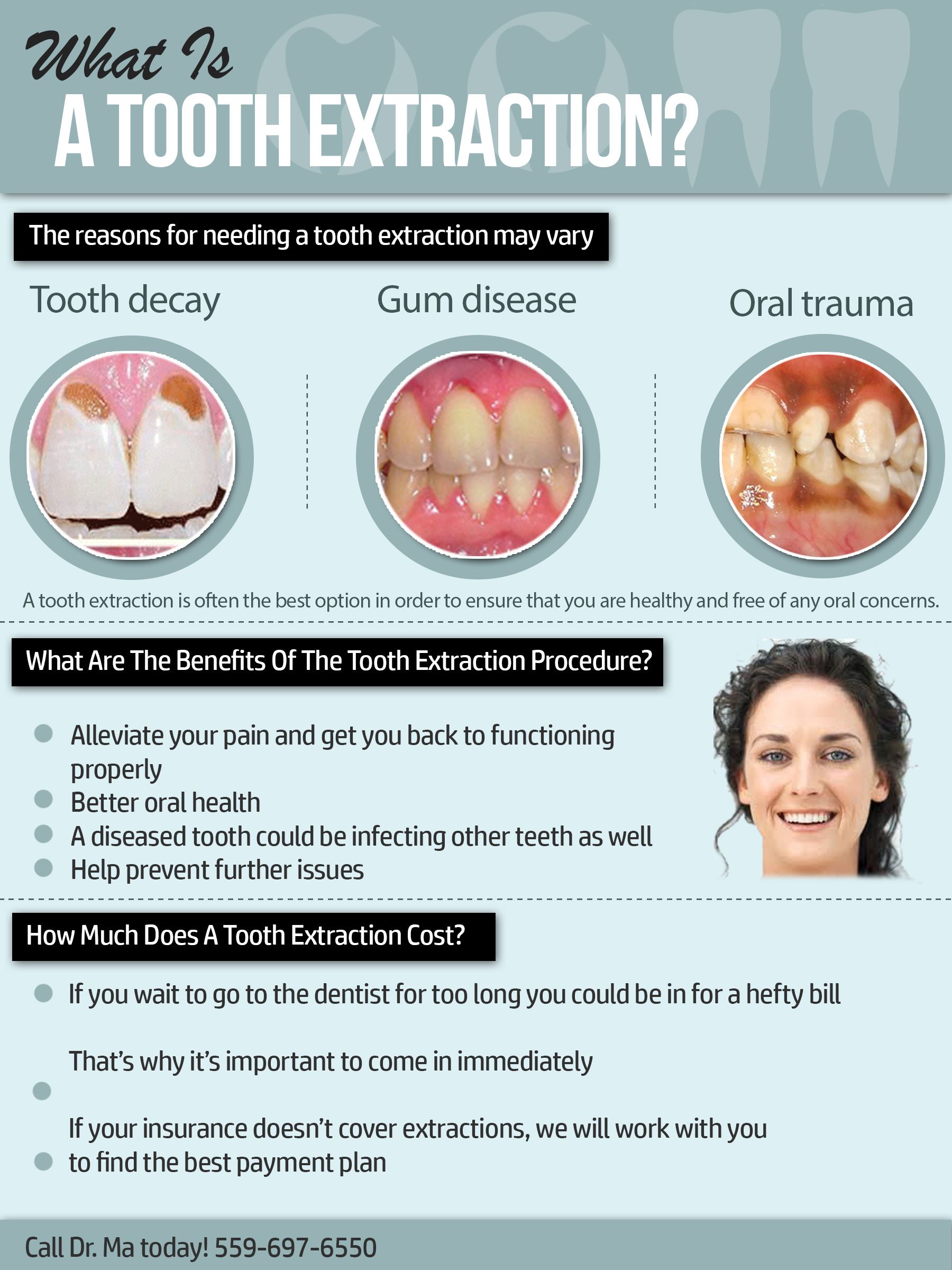 tooth extraction post op instructions